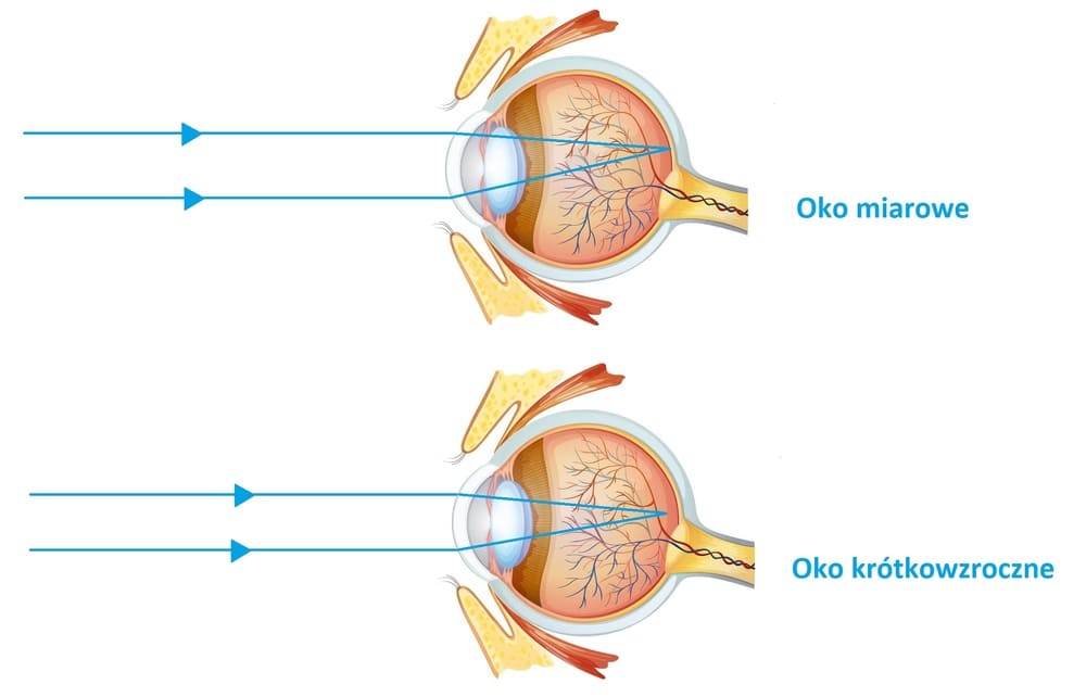 Skupianie światła w oku miarowym czyli normowzrocznym oraz w oku krótkowzrocznym